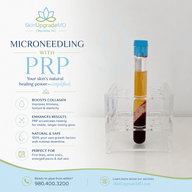 PRP Microneedling at SkinUpgradeMD in Charlotte, NC
